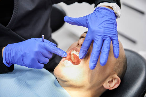 Best Emergency Wisdom Tooth Extraction in Mojave, CA